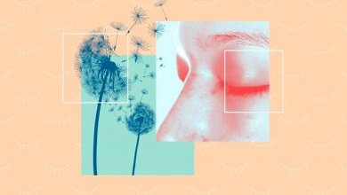 پزشکی دانستنیهایی درباره ورم ملتحمه آلرژیک