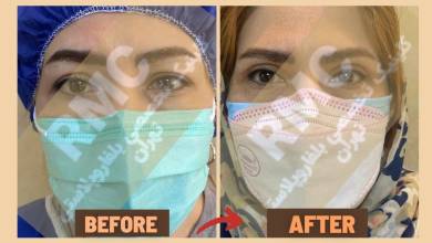 پزشکی کلینیک تخصصی بلفاروپلاستی تهران