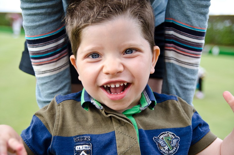 بیماری سندرم آنجلمن چیست ؟