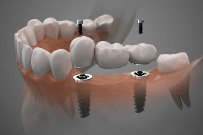 پزشکی پزشکی