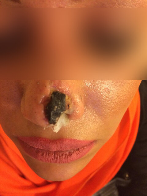 پزشکی زیبایی به قیمت جان و مجازات ۵ میلیون تومانی پزشکنماها!