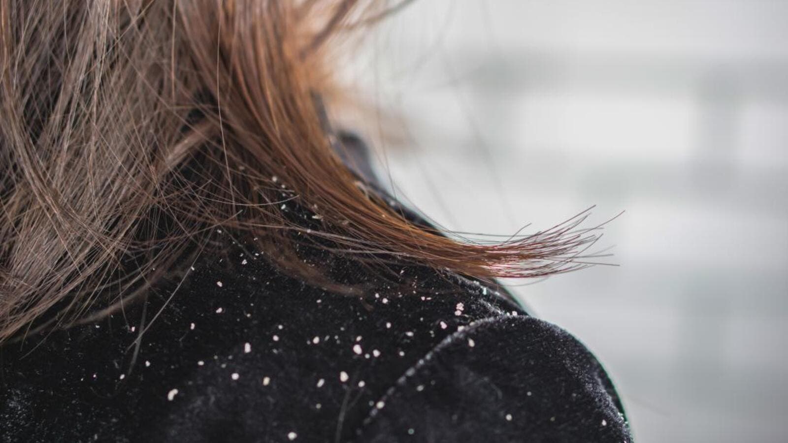 عمومی عمومی