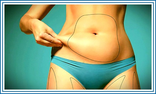  مزایای پیکر تراشی بدون جراحی 