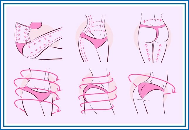 لیپوساکشن یکی از انواه روش های پیکر تراشی بدون جراحی می باشد 