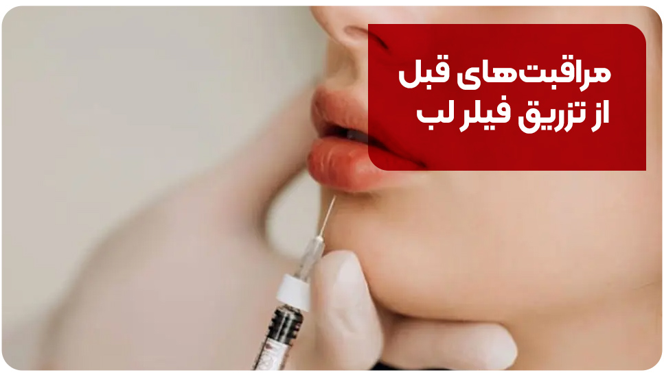 مراقبت&zwnj;های قبل از تزریق فیلر لب