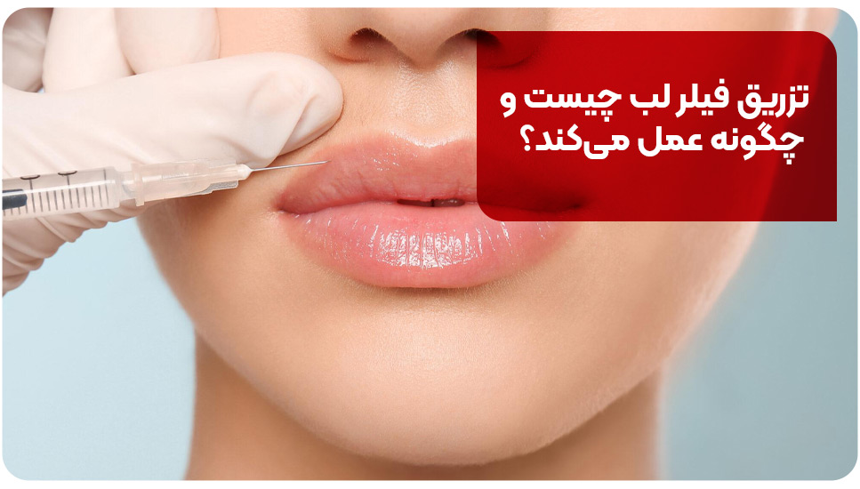 تزریق فیلر لب چیست و چگونه عمل می&zwnj;کند؟