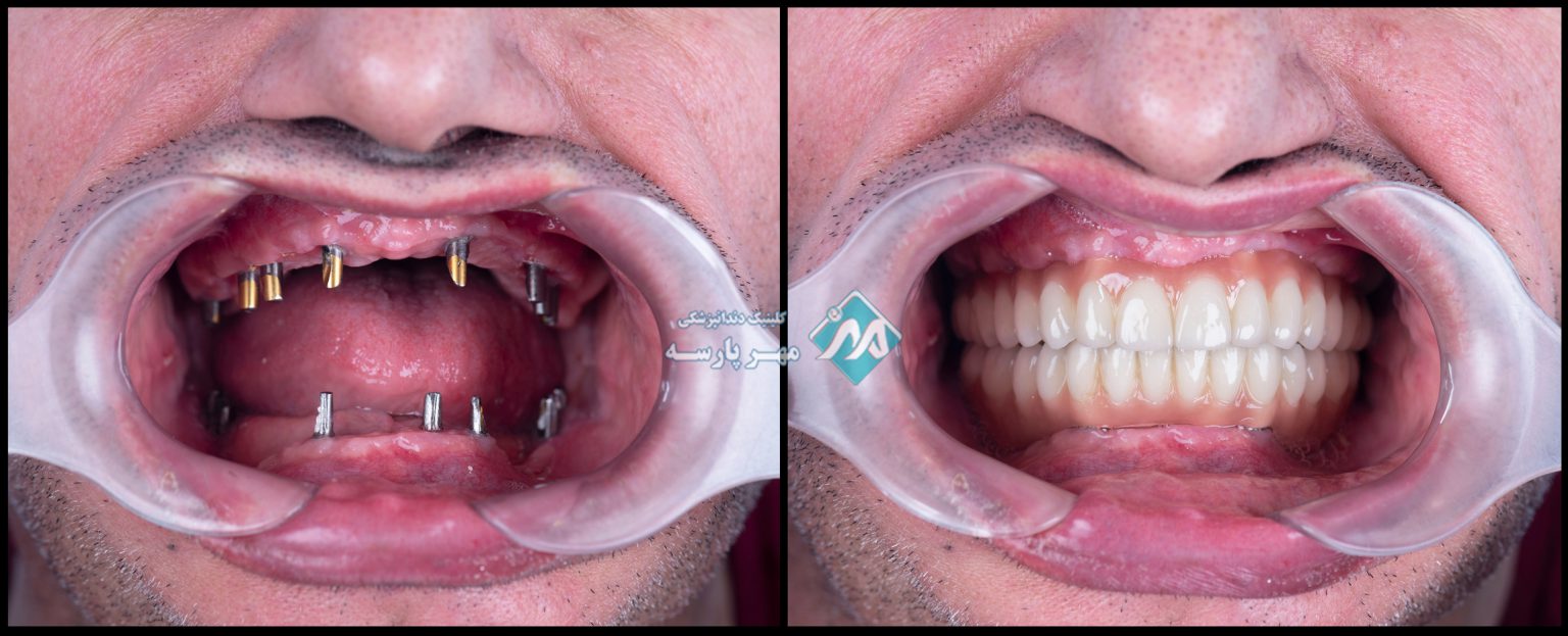 تهران | دندانپزشکی